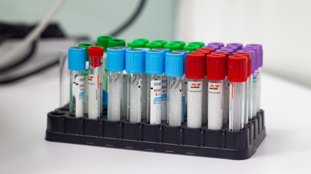 Batch samples prepared for certificate of analysis testing