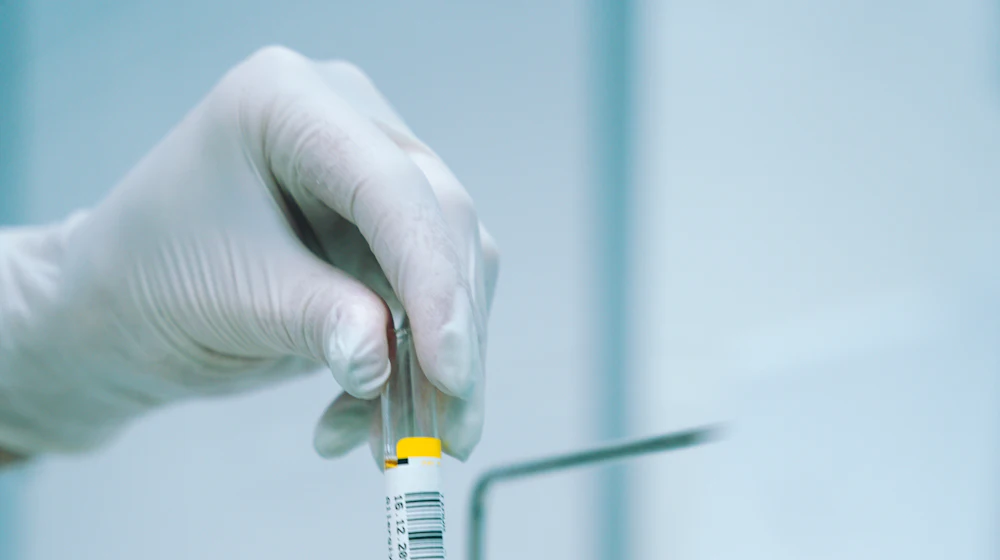 Gloved hand holding a sample tube during HPLC purity analysis