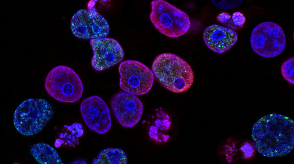 Microscopy image of tissue cells used in repair research